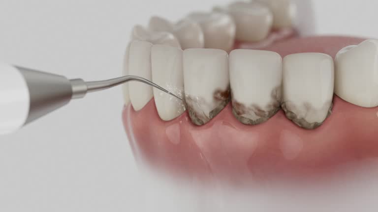 Reliable Root Canal Treatment contractor in Cross County County, AR by Dentist Open Now
